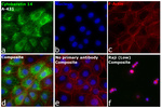Cytokeratin 14 Antibody