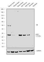 LAP2 Antibody in Western Blot (WB)