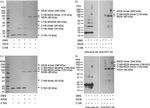 Hepatitis C Virus Core Antigen Antibody in Western Blot (WB)