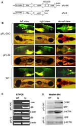 Hepatitis C Virus Core Antigen Antibody in Western Blot (WB)