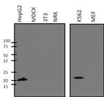 SOD1 Antibody in Western Blot (WB)