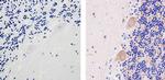 SOD2 Antibody in Immunohistochemistry (Paraffin) (IHC (P))