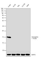 Hemoglobin Monoclonal Antibody (HB11-203.1)