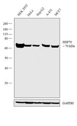 HSP70 Monoclonal Antibody (C92F3A-5)