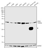 CDK4 Monoclonal Antibody (DCS31.2)