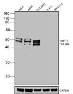 Cytokeratin 7 Antibody