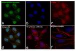 Progesterone Receptor Antibody