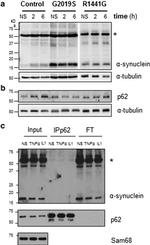 alpha Synuclein Antibody in Western Blot (WB)