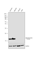 alpha Synuclein Antibody