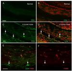 CD4 Antibody in Immunohistochemistry (IHC)