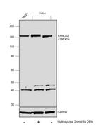 FANCD2 Antibody in Western Blot (WB)