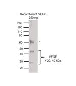 VEGF Monoclonal Antibody (VG76e)