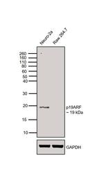 p19ARF Antibody in Western Blot (WB)