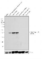 Cardiac Troponin T Monoclonal Antibody (1C11cc)