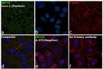 Cytokeratin 18 Antibody