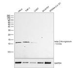 beta-2 Microglobulin Monoclonal Antibody (B2M-01)