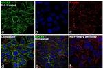 SOCS3 Monoclonal Antibody (SO1)