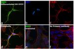 MAP2 Monoclonal Antibody (MT-08)
