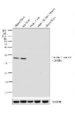 Cardiac Troponin I Monoclonal Antibody (16A11)