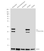 Cardiac Troponin I Monoclonal Antibody (MF4)