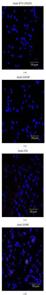 NGFR Antibody in Immunocytochemistry (ICC/IF)