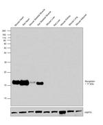 Myoglobin Monoclonal Antibody (4E2)