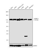 hnRNP U Antibody in Western Blot (WB)