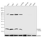 S100A6 Antibody in Western Blot (WB)