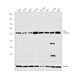 Coilin Monoclonal Antibody (Pdelta)