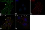 Alpha-Smooth Muscle Actin Monoclonal Antibody (0.N.5)