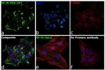 NEFM Antibody in Immunocytochemistry (ICC/IF)