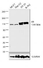 Rb Antibody in Western Blot (WB)