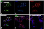 beta Amyloid Antibody in Immunocytochemistry (ICC/IF)