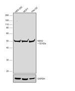NEK2 Monoclonal Antibody (1B6)