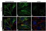 GLUT1 Antibody in Immunocytochemistry (ICC/IF)