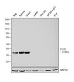 CD20 Antibody in Western Blot (WB)