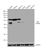 LCK Monoclonal Antibody (33D196)