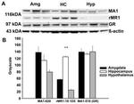 NR3C2 Antibody in Western Blot (WB)