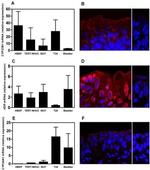VDR Antibody in Immunohistochemistry, Immunocytochemistry (IHC, ICC/IF)