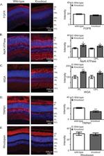 GRK1 Antibody in Immunohistochemistry (IHC)