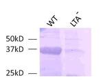 Gram Positive Bacteria LTA Monoclonal Antibody (G43J)