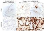 SARS/SARS-CoV-2 Nucleocapsid Antibody in Immunohistochemistry (IHC)