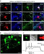PLP1 Antibody in Immunohistochemistry (IHC)