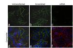 IGF1R alpha Antibody