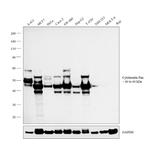 Cytokeratin Pan Type I/II Antibody