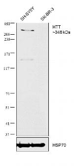 Huntingtin Monoclonal Antibody (HDC8A4)
