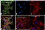 Angiotensin I Antibody in Immunocytochemistry (ICC/IF)