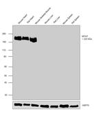 MYH7 Antibody in Western Blot (WB)