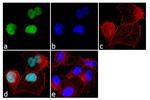 NCoR2 Antibody in Immunocytochemistry (ICC/IF)