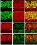 PMCA4 ATPase Antibody in Immunohistochemistry, Immunocytochemistry (IHC, ICC/IF)